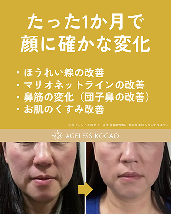 お客様の声1　たった1か月で顔に確かな変化　ほうれい線の改善　マリオネットラインの改善　鼻筋の変化（団子鼻の改善）　お肌のくすみ改善　※エイジレス小顔スクールでの効果実績。効果には個人差があります。