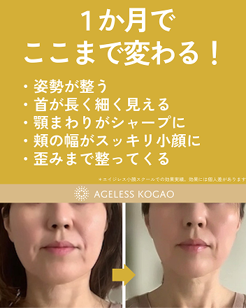 お客様の声2　1か月でここまで変わる！　姿勢が整う　首が長く細く見える　顎まわりがシャープに　頬の幅がスッキリ小顔に　歪みまで整ってくる　※エイジレス小顔スクールでの効果実績。効果には個人差があります。